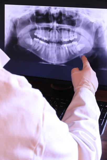 Best Emergency Denture Repair in Silver Lake, FL