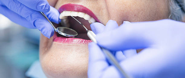 Best Broken or Chipped Tooth Repair in Silver Lake, FL